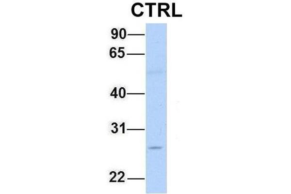 Chymotrypsin anticorps  (N-Term)