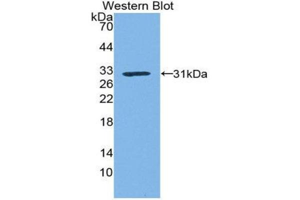 anti-Kallikrein 1 (KLK1) (AA 21-261) antibody