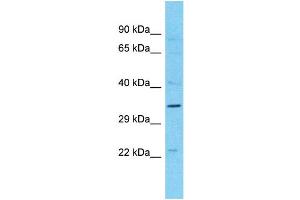 Western Blotting (WB) image for anti-Melanoma Antigen Family B, 10 (MAGEB10) (N-Term) antibody (ABIN2791656)