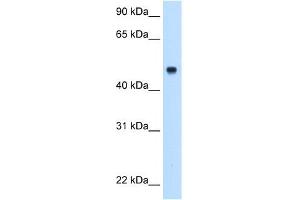 Image no. 3 for anti-Complement Component 8, beta Polypeptide (C8B) (Middle Region) antibody (ABIN2781763)