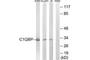 Image no. 1 for anti-Complement Component 1, Q Subcomponent Binding Protein (C1QBP) (AA 61-110) antibody (ABIN1534795)