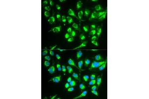 Image no. 2 for anti-Solute Carrier Family 22 Member 5 (SLC22A5) antibody (ABIN3022379)