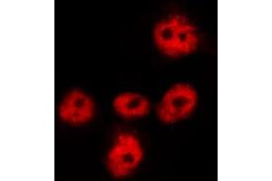 Image no. 3 for anti-Forkhead Box O1 (FOXO1) (pSer256) antibody (ABIN6255137)
