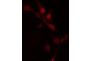 Image no. 1 for anti-Microtubule Associated serine/threonine Kinase-Like (MASTL) antibody (ABIN6259099)