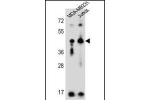 KIR2DL2 antibody  (C-Term)