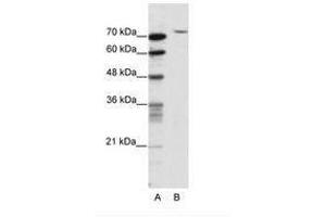 Image no. 1 for anti-TAF6 RNA Polymerase II, TATA Box Binding Protein (TBP)-Associated Factor, 80kDa (TAF6) (N-Term) antibody (ABIN202866)