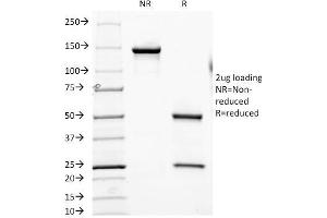 Image no. 4 for anti-Folate Hydrolase (Prostate-Specific Membrane Antigen) 1 (FOLH1) (AA 232-433) antibody (ABIN6939424)