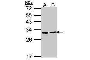 Image no. 1 for anti-FK506 Binding Protein 3, 25kDa (FKBP3) (Center) antibody (ABIN2856136)