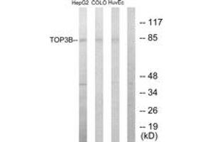 Image no. 1 for anti-Topoisomerase (DNA) III beta (TOP3B) (AA 51-100) antibody (ABIN1533574)