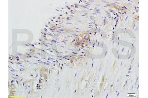Formalin-fixed and paraffin embedded rat colitis labeled with Anti-CD28 Polyclonal Antibody, Unconjugated (ABIN674604) at 1:200 followed by conjugation to the secondary antibody and DAB staining.