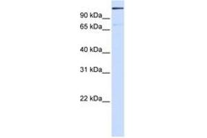Image no. 1 for anti-Tankyrase 1 Binding Protein 1, 182kDa (TNKS1BP1) (AA 1512-1561) antibody (ABIN6744262)