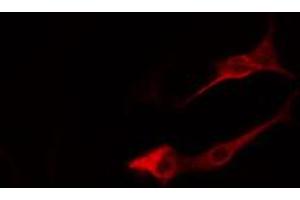 Image no. 3 for anti-ADP-Ribosylation Factor 4 (ARF4) (Internal Region) antibody (ABIN6258696)