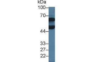 Image no. 2 for anti-Debranching Enzyme Homolog 1 (DBR1) (AA 243-372) antibody (ABIN1176739)