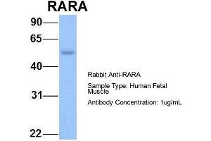 Image no. 3 for anti-Retinoic Acid Receptor, alpha (RARA) (N-Term) antibody (ABIN2778740)
