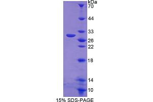Image no. 1 for Nitric Oxide Synthase 2, Inducible (NOS2) (AA 734-966) protein (His tag) (ABIN6239953)