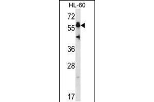 Image no. 1 for anti-Heat Shock Transcription Factor 4 (HSF4) (AA 100-128), (N-Term) antibody (ABIN5531382)
