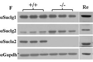 Image no. 5 for anti-Succinate-CoA Ligase, GDP-Forming, beta Subunit (SUCLG2) (Center) antibody (ABIN2856470)