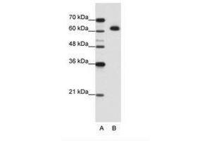 Image no. 2 for anti-DIS3-Like Exonuclease 2 (DIS3L2) (AA 121-170) antibody (ABIN202821)