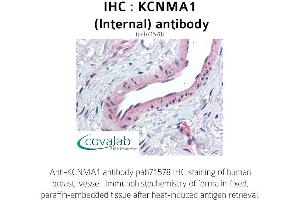 Image no. 1 for anti-Potassium Large Conductance Calcium-Activated Channel, Subfamily M, alpha Member 1 (KCNMA1) (Internal Region) antibody (ABIN1736190)