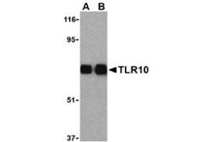 Image no. 1 for anti-Toll-Like Receptor 10 (TLR10) (Center) antibody (ABIN500940)