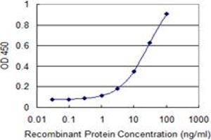 anti-Chromodomain Protein, Y-Like (CDYL) (AA 153-260) antibody