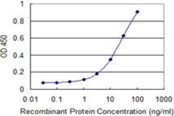 anti-Chromodomain Protein, Y-Like (CDYL) (AA 153-260) antibody