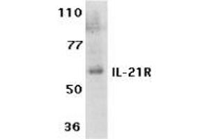 Image no. 2 for anti-Interleukin 21 Receptor (IL21R) (Extracellular Domain) antibody (ABIN499988)
