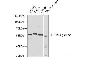 Western blot analysis of extracts of various cell lines using PPAR gamma Polyclonal Antibody at dilution of 1:1000.