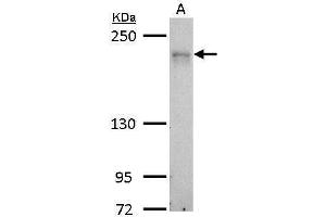 Image no. 3 for anti-CDC42 Binding Protein Kinase alpha (DMPK-Like) (CDC42BPA) (Center) antibody (ABIN2855436)