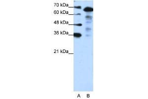 Image no. 2 for anti-MLX Interacting Protein-Like (MLXIPL) (N-Term) antibody (ABIN925930)