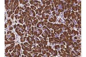 Image no. 1 for anti-Pancreatic Lipase (PNLIP) (AA 1-465) antibody (ABIN6923381)