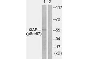 Western blot analysis of extracts from HepG2 cells treated with Anisomycin 25ug/ml 30', using XIAP (Phospho-Ser87) Antibody.
