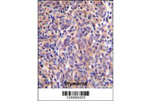 Image no. 1 for anti-Thymocyte Selection Associated (THEMIS) (AA 559-588), (C-Term) antibody (ABIN655135)