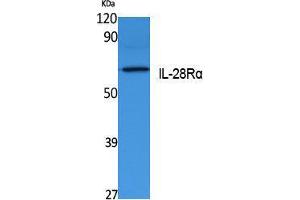 Image no. 1 for anti-Interleukin 28 Receptor, alpha (Interferon, lambda Receptor) (IL28RA) (Internal Region) antibody (ABIN3180976)