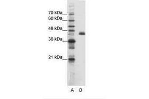 Image no. 1 for anti-Zinc Finger Protein 36, C3H Type-Like 2 (ZFP36L2) (N-Term) antibody (ABIN202655)