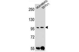 Image no. 3 for anti-Protocadherin 1 (PCDH1) (AA 186-214), (N-Term) antibody (ABIN954026)