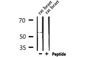 Image no. 2 for anti-Matrix Metallopeptidase 10 (Stromelysin 2) (MMP10) (Internal Region) antibody (ABIN6266249)