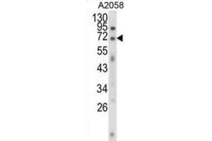 Image no. 2 for anti-Ewing Sarcoma Breakpoint Region 1 (EWSR1) antibody (ABIN3003929)