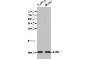 Image no. 1 for anti-Hepatitis B Virus X-Interacting Protein (HBXIP) antibody (ABIN2737099)