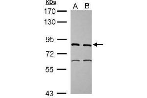 anti-Excision Repair Cross-Complementing Rodent Repair Deficiency, Complementation Group 2 (ERCC2) (Internal Region) antibody