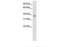 Image no. 1 for anti-Small Nuclear RNA Activating Complex, Polypeptide 3, 50kDa (SNAPC3) (N-Term) antibody (ABIN202459)