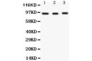 Image no. 3 for anti-FER Tyrosine Kinase (FER) (AA 521-536), (Middle Region) antibody (ABIN3044101)