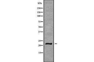 Image no. 2 for anti-Glycoprotein Ib (Platelet), beta Polypeptide (GP1BB) antibody (ABIN6262037)