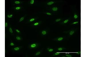 Image no. 1 for anti-Mesoderm Posterior 2 Homolog (Mesp2) (AA 2-125) antibody (ABIN530901)