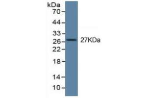 Image no. 6 for Tumor Necrosis Factor alpha (TNF alpha) ELISA Kit (ABIN6574140)