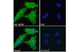 Image no. 4 for anti-Matrix Metallopeptidase 9 (Gelatinase B, 92kDa Gelatinase, 92kDa Type IV Collagenase) (MMP9) (Internal Region) antibody (ABIN5539846)