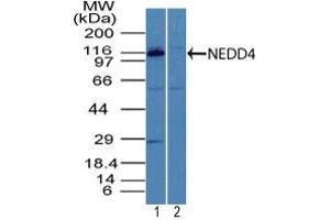 Image no. 1 for anti-Neural Precursor Cell Expressed, Developmentally Down-Regulated 4, E3 Ubiquitin Protein Ligase (NEDD4) (AA 200-250) antibody (ABIN960274)