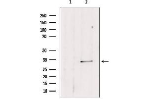 Image no. 2 for anti-Sulfotransferase Family 1E Member 1 (SULT1E1) (Internal Region) antibody (ABIN6265370)
