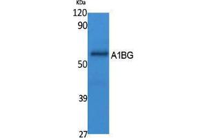 Image no. 1 for anti-alpha-1-B Glycoprotein (A1BG) (Internal Region) antibody (ABIN3187622)