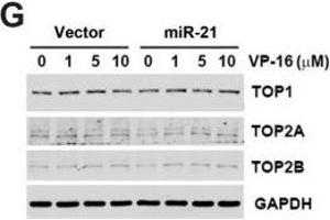 Effect of miR-21 overexpression on chemosensitivity.